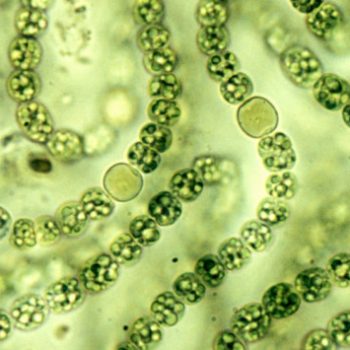 Microscopic Cyanobacteria